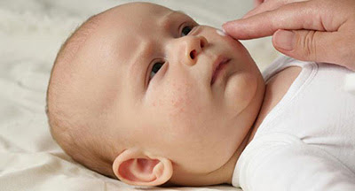 بیماری روزئولا در نوزادان و کودکان:علل،علائم و درمان
داروی روزئولا،علت...